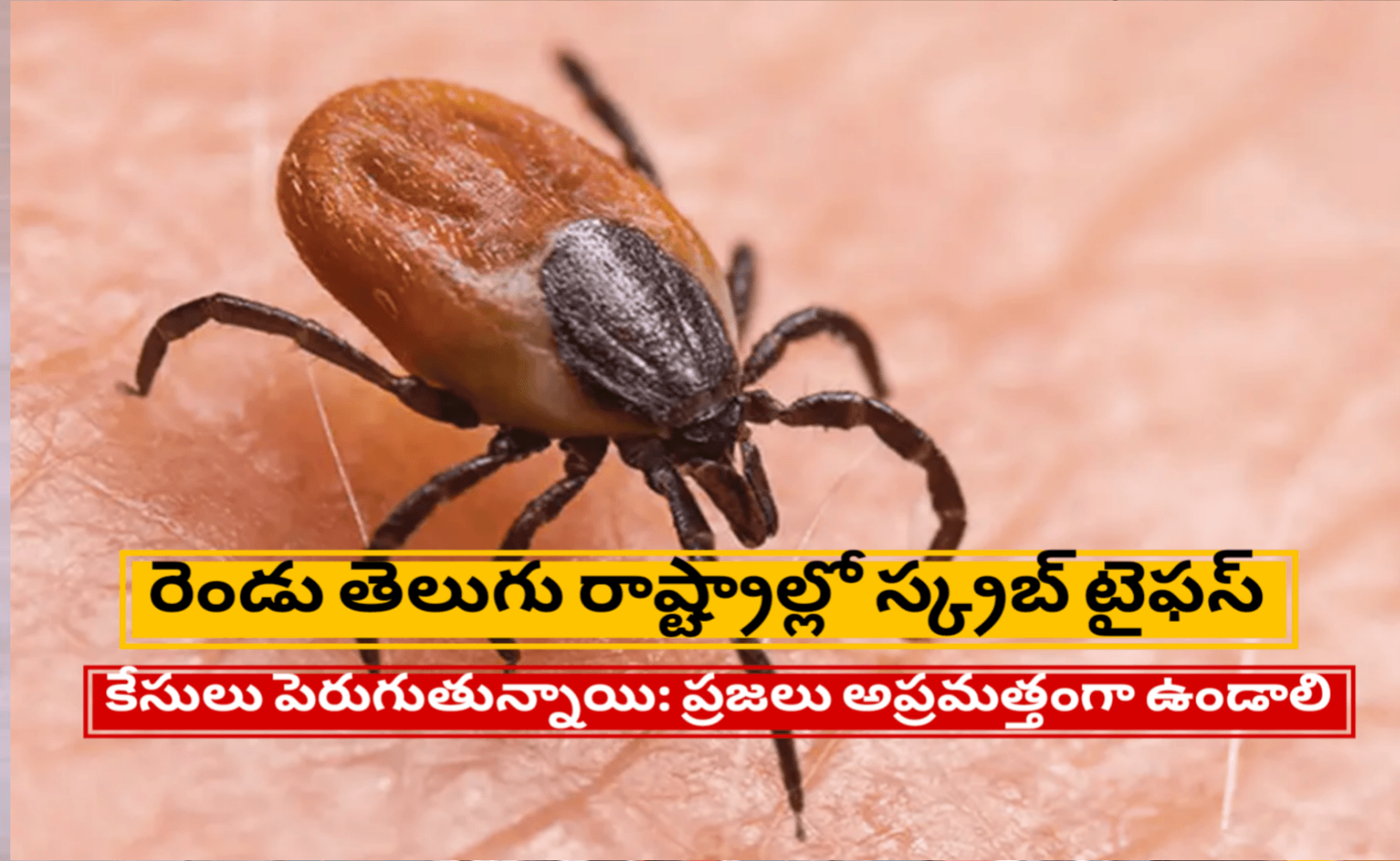 రెండు తెలుగు రాష్ట్రాల్లో స్క్రబ్ టైఫస్ కేసులు పెరుగుతున్నాయి: ప్రజలు అప్రమత్తంగా ఉండాలి